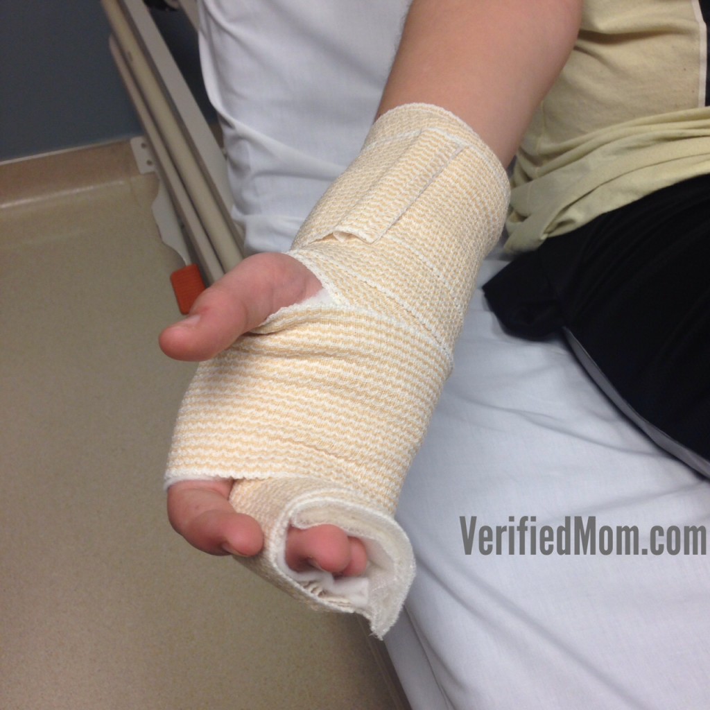 sprained hand and fingers